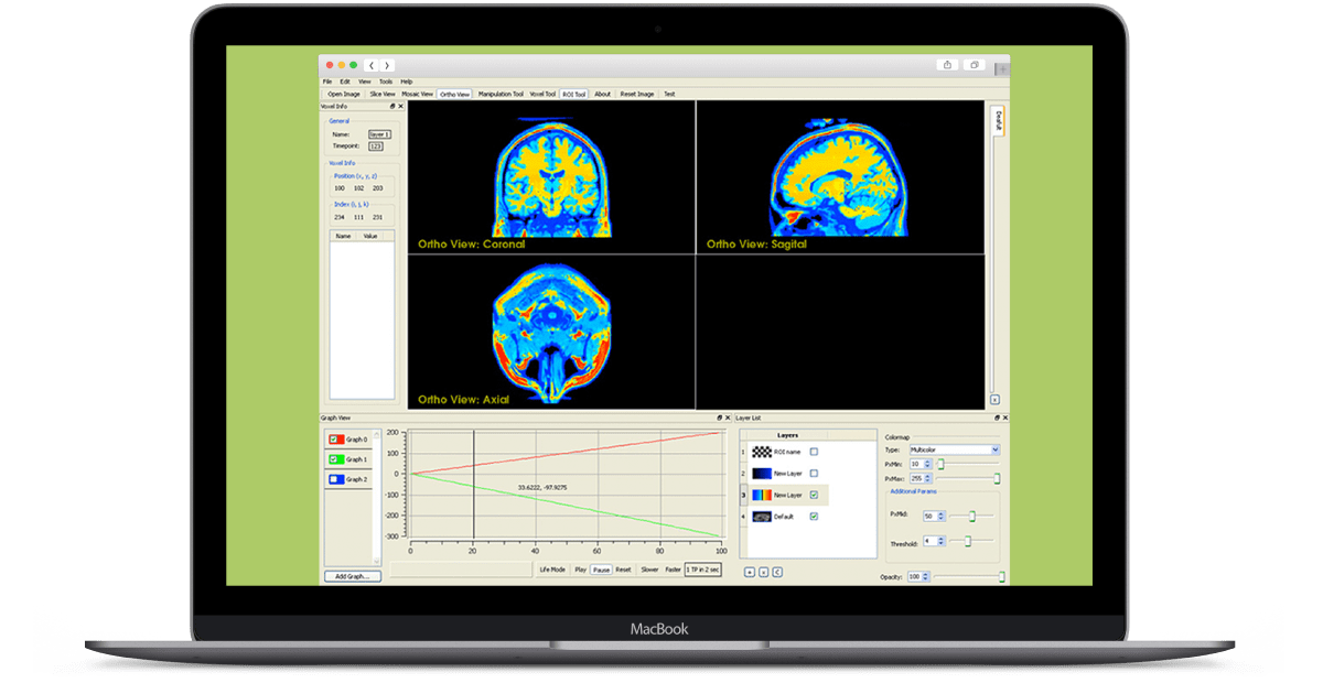 MRI-Imaging-Research-Application main