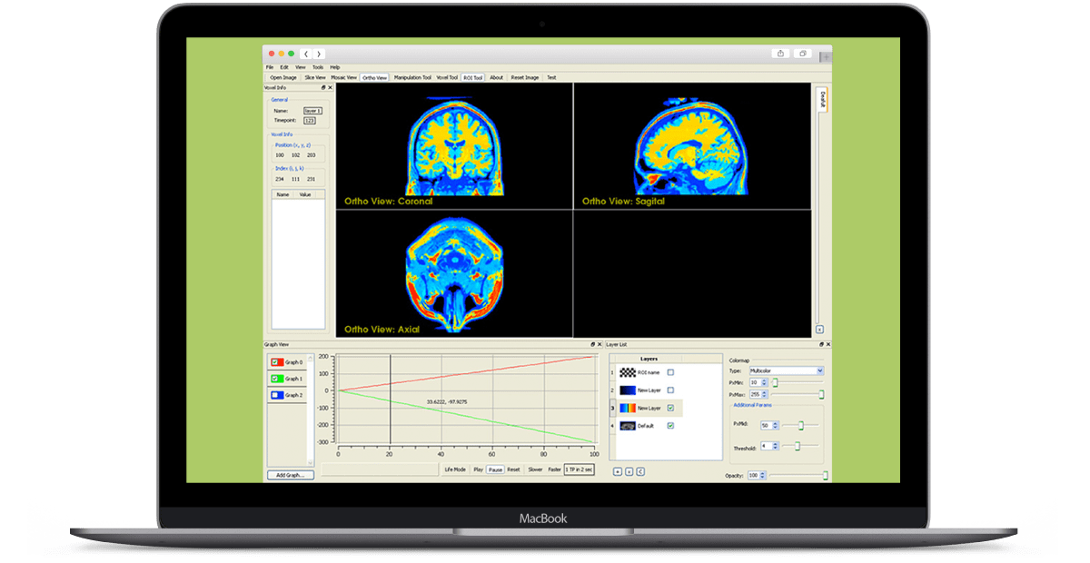 MRI-Imaging-Research-Application main