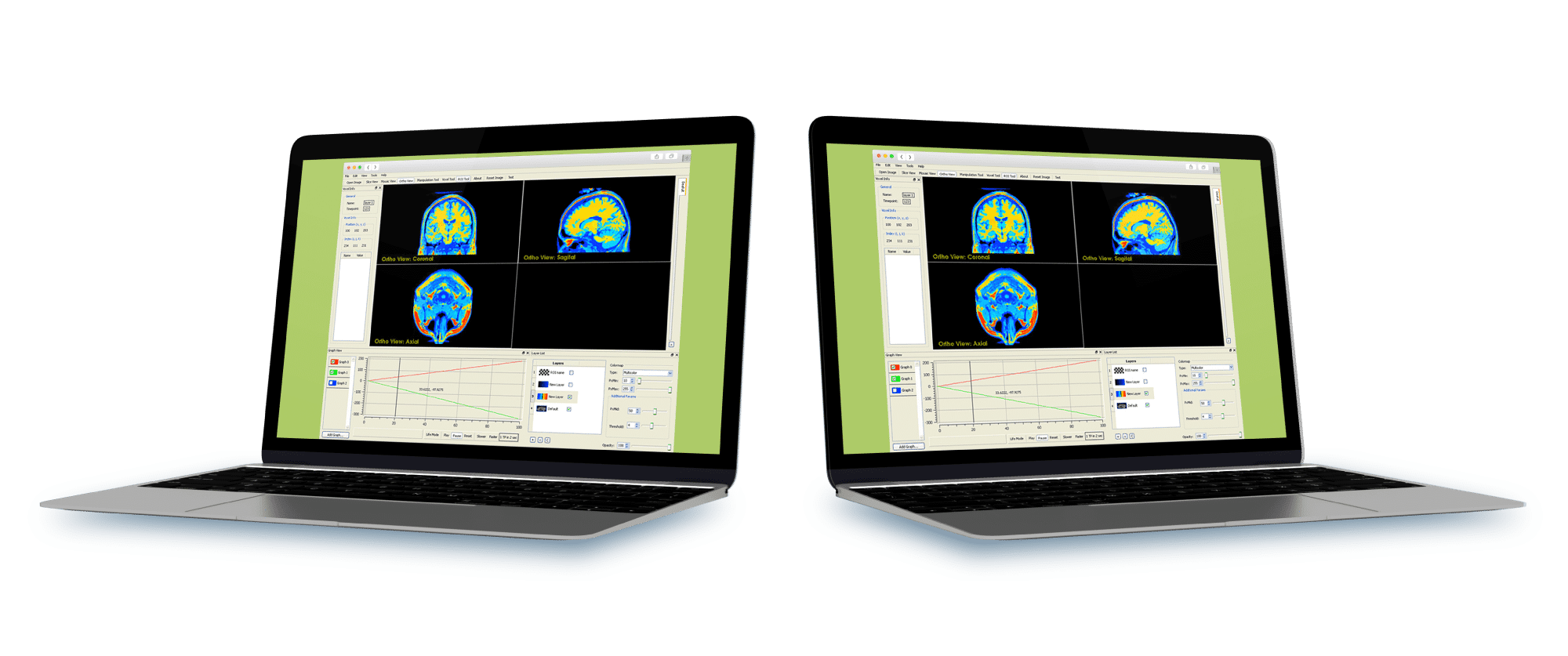 MRI-Imaging-Research-Application_Scopic_Solution MRI-Imaging-Research-Application solution