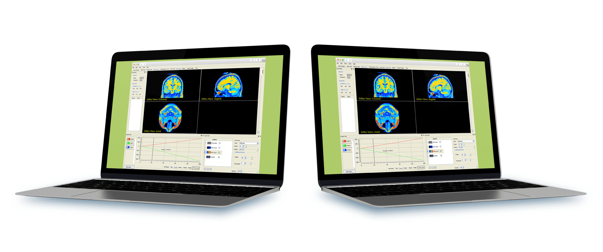 MRI-Imaging-Research-Application solution