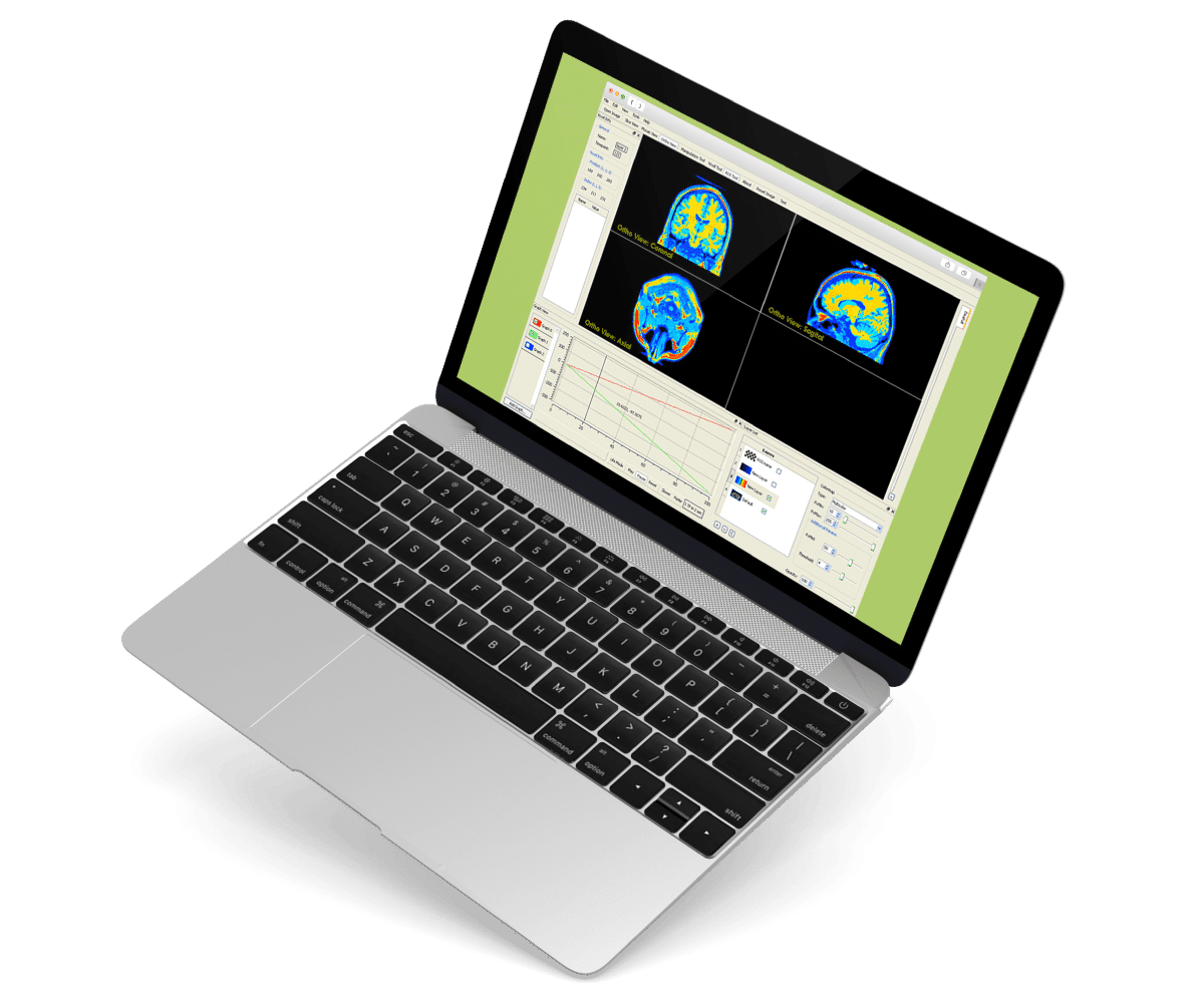 MRI-Imaging-Research-Application vision