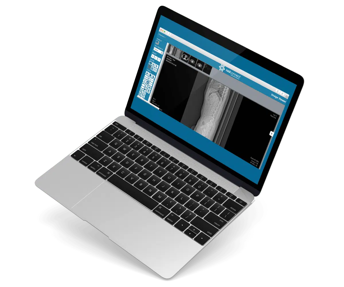 Radconnect vision
