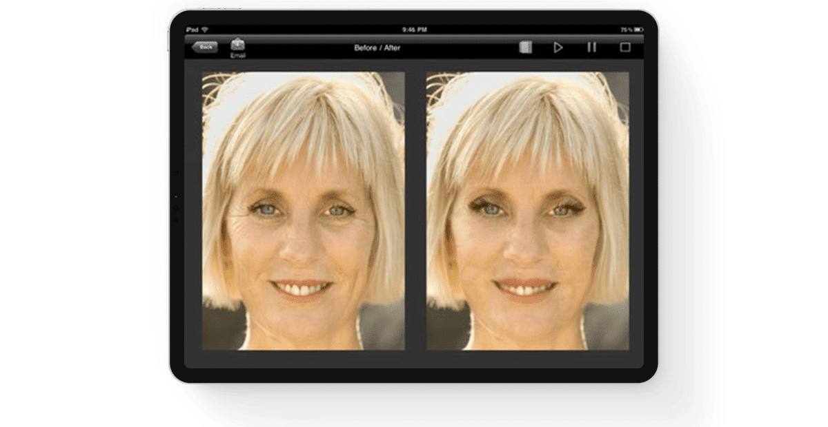 Plastic-Surgery-Visualization-Application main