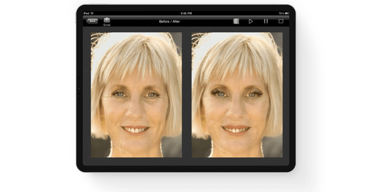 Plastic-Surgery-Visualization-Application main