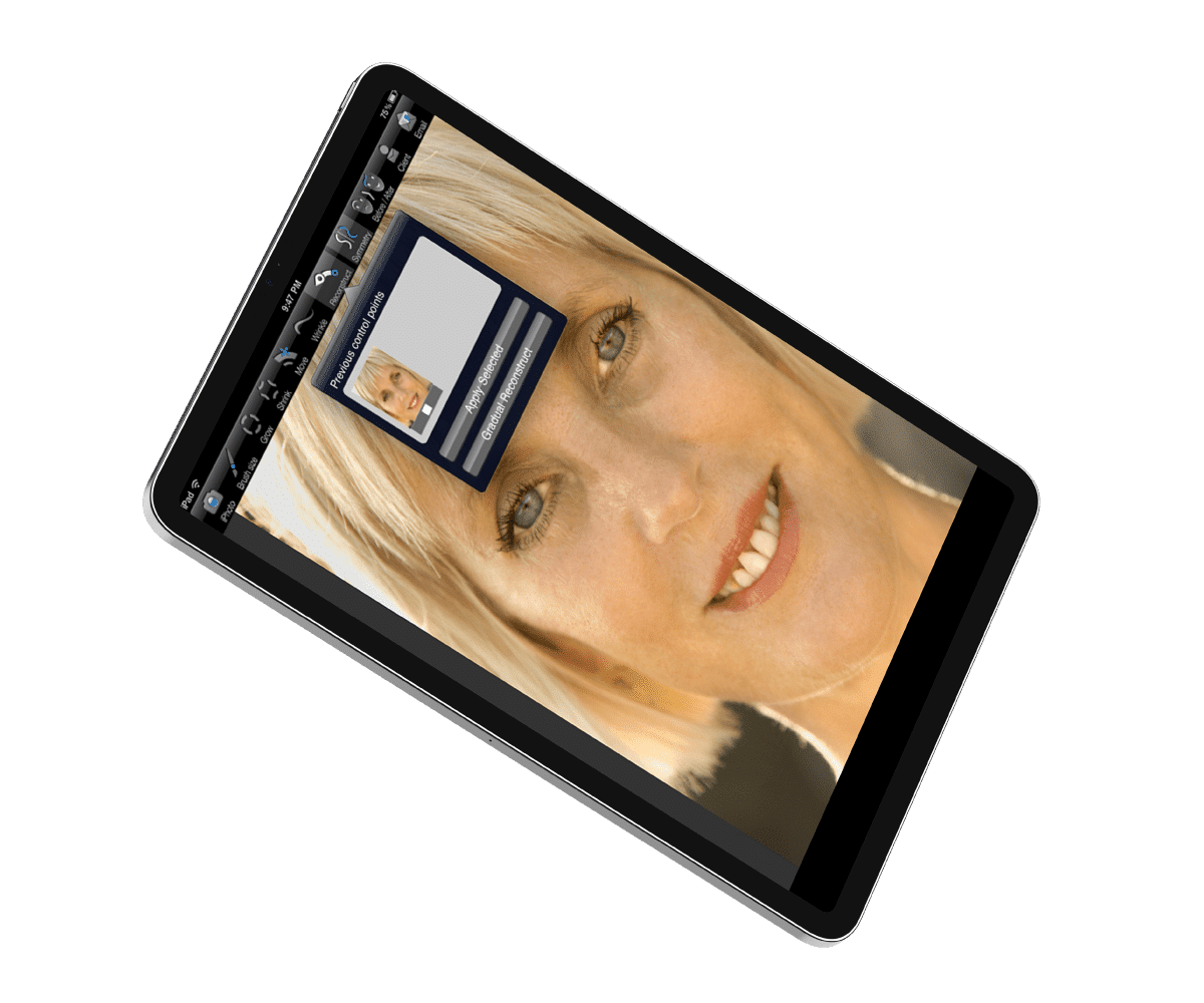 Plastic-Surgery-Visualization-Application vision
