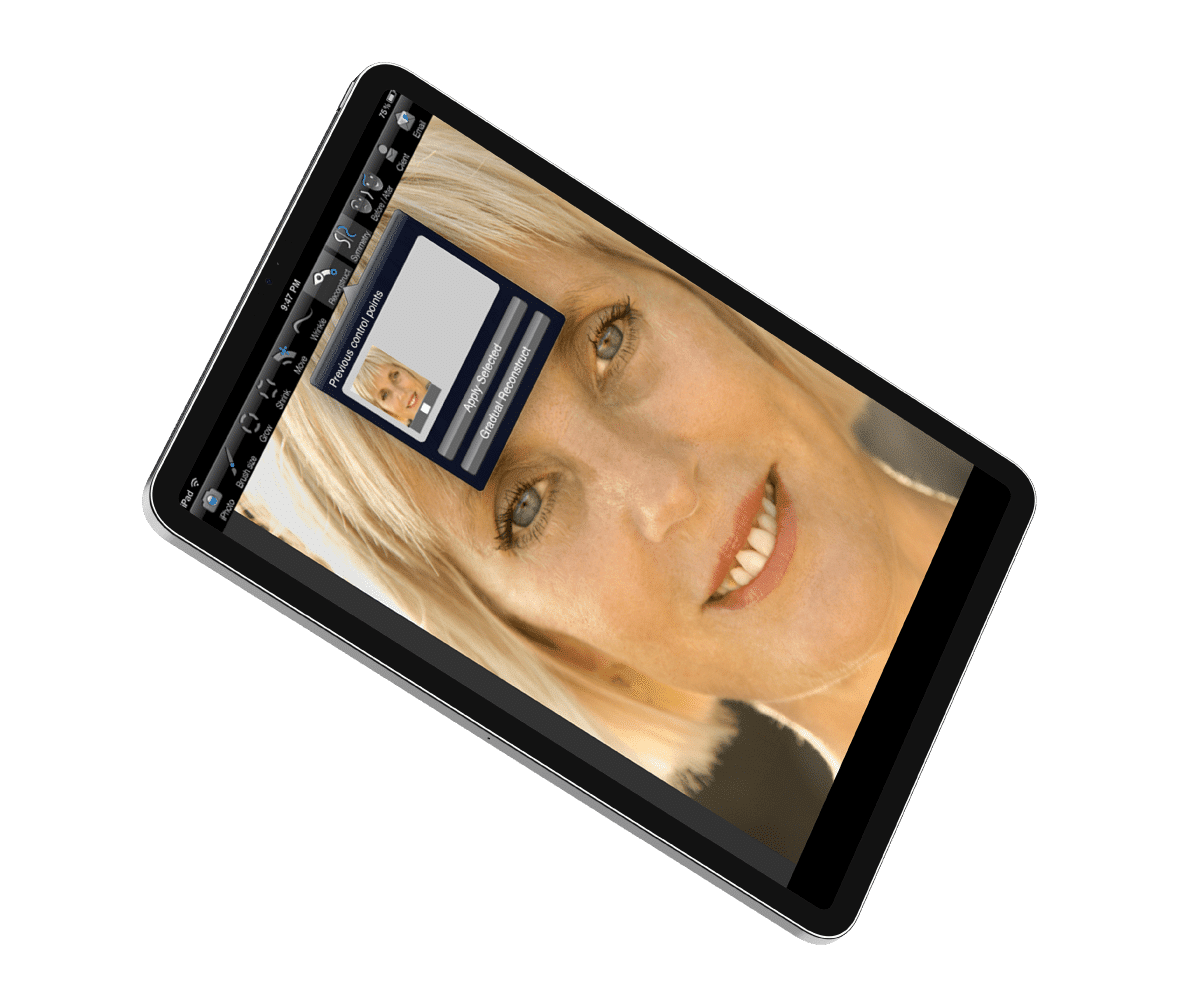 Plastic-Surgery-Visualization-Application vision