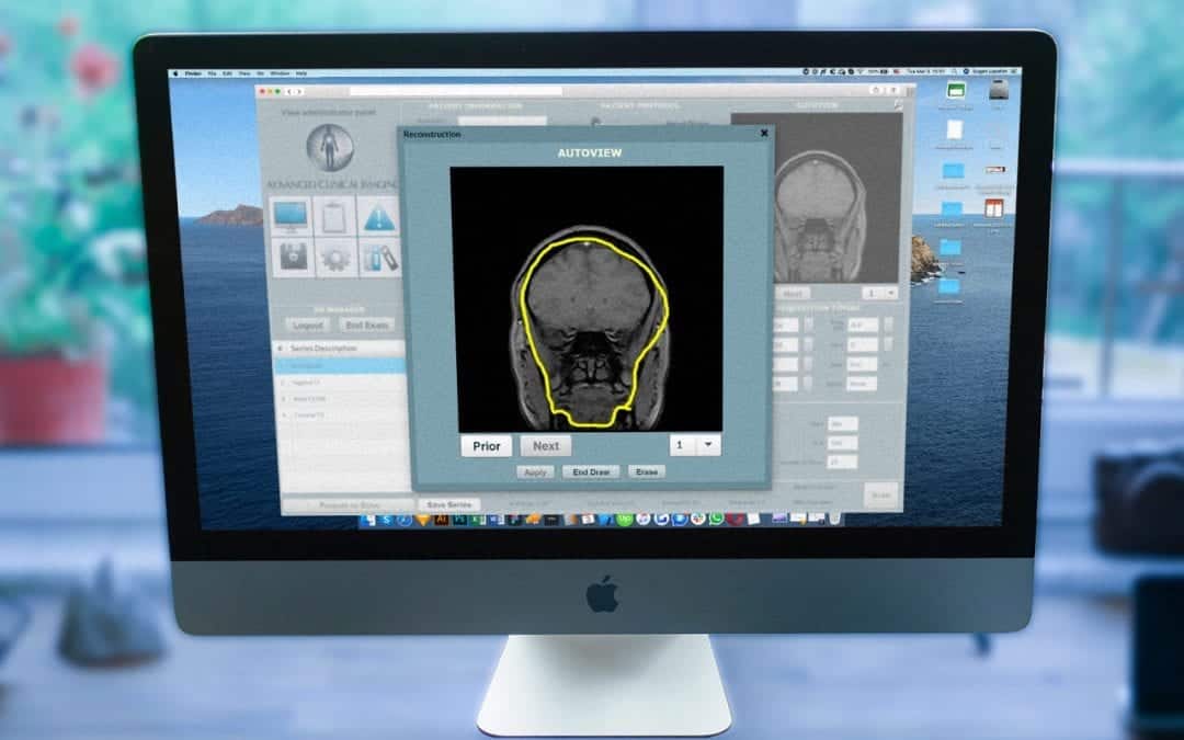 MRI and CT Simulators