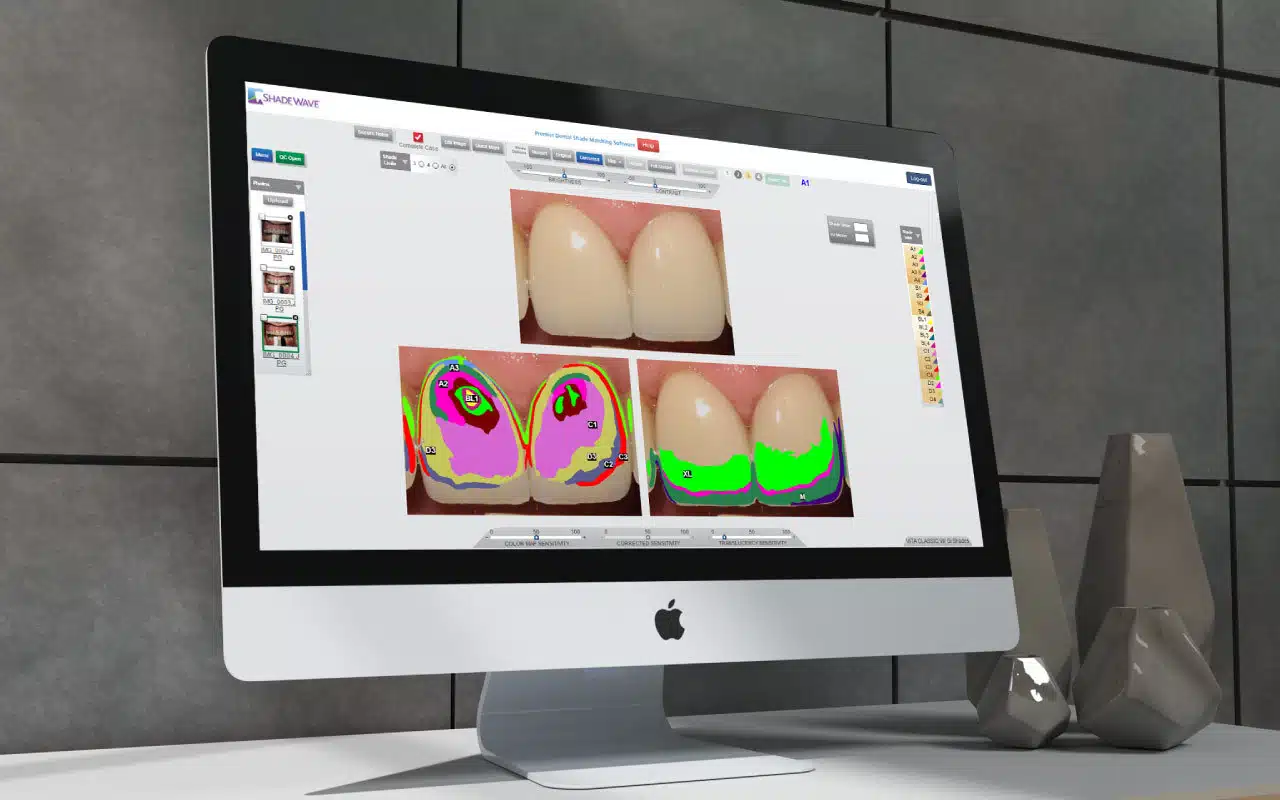 Offshore Developers Elevate Shadewave to Top Dental App