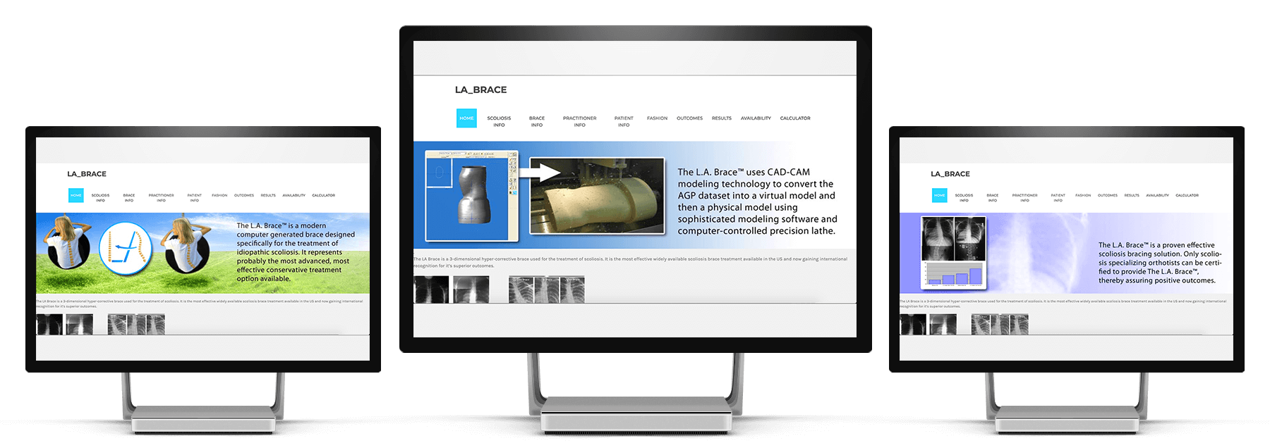 TorsoManagementVisualizationSystem solution