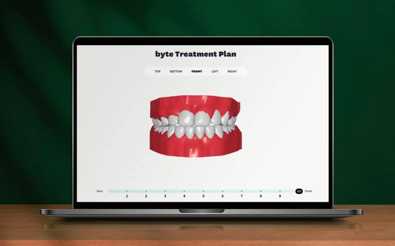 ByteMe 3D Treatment Viewer