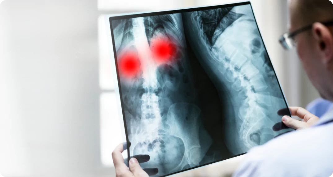 Radiology Information Systems 101: An Ultimate Guide