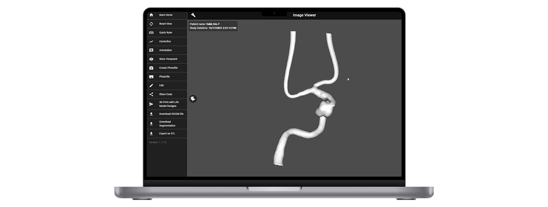 AngioCloud_Scopic_solution