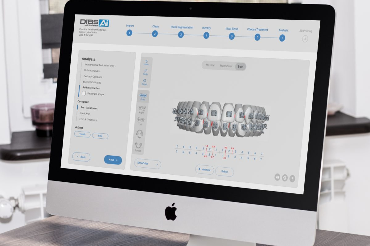 Revolutionizing Orthodontics: OrthoSelect’s AI-Powered Treatment Planning